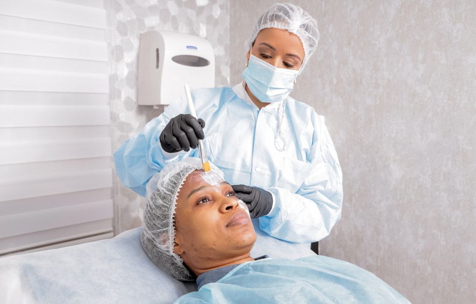 Unlocking the Secrets of Chemical Peel Treatments